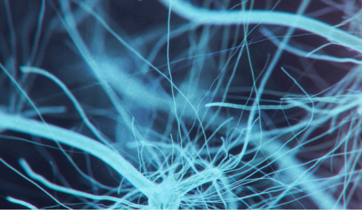 Neural network