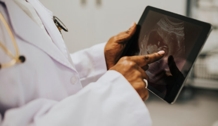 Midwife,Looking,At,A,Sonogram